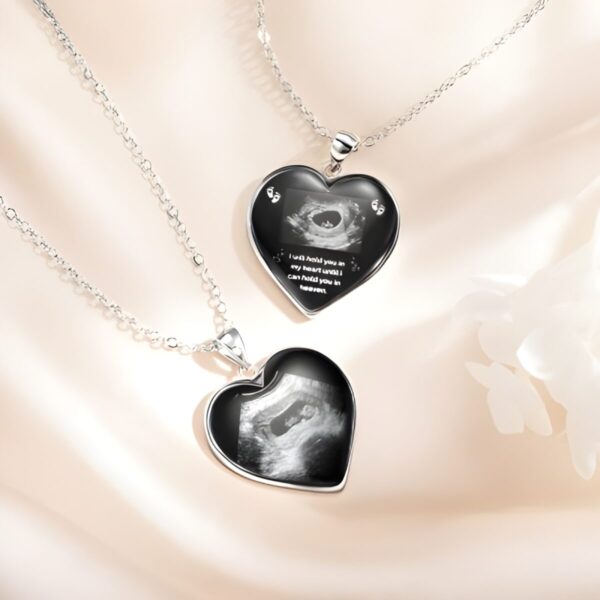 Ultrasound sonogram necklace for moms embracing new life